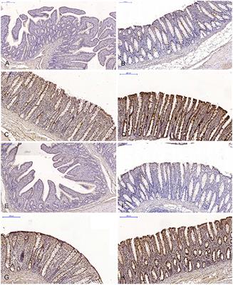 The Effect of 42-Day Exposure to a Low Deoxynivalenol Dose on the Immunohistochemical Expression of Intestinal ERs and the Activation of CYP1A1 and GSTP1 Genes in the Large Intestine of Pre-pubertal Gilts